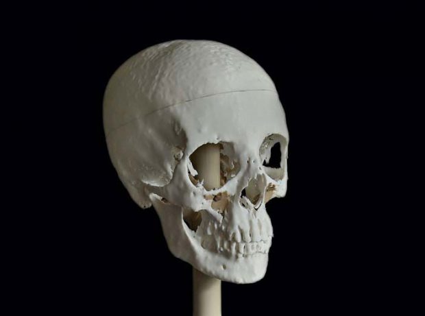 Meritamun's skull